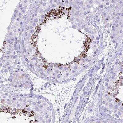 Immunohistochemistry-Paraffin: MON1A Antibody [NBP2-31702]