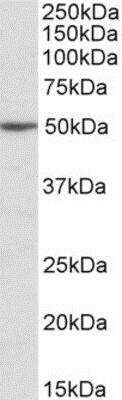 Western Blot: MON1A Antibody [NBP1-52006]