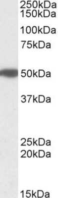 Western Blot: MON1A Antibody [NBP1-52007]