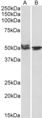 Western Blot: MON1A Antibody [NBP1-52007]