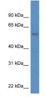 Western Blot: MON1A Antibody [NBP1-74123]