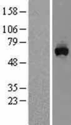Western Blot: MON1A Overexpression Lysate [NBL1-13179]