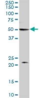 Western Blot: MON1B Antibody [H00022879-B01P]