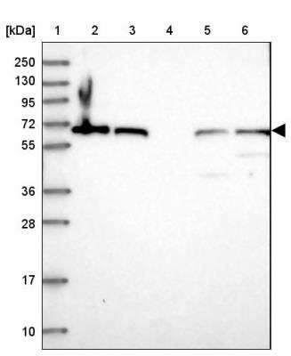 Western Blot: MON1B Antibody [NBP1-92131]