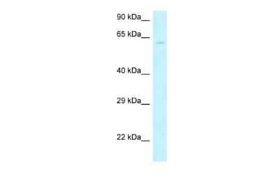 Western Blot: MON1B Antibody [NBP2-85303]