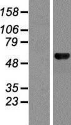 Western Blot: MON1B Overexpression Lysate [NBP2-07240]