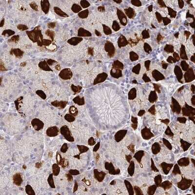 Immunohistochemistry: MON2 Antibody [NBP2-38831]