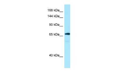 Western Blot: MON2 Antibody [NBP2-83219]