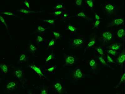 Immunocytochemistry/ Immunofluorescence: MORC1 Antibody [NBP2-98518]