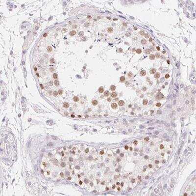 Immunohistochemistry-Paraffin: MORC1 Antibody [NBP1-84351]