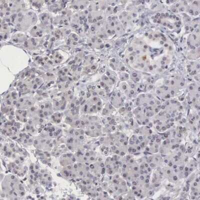 Immunohistochemistry-Paraffin: MORC2 Antibody [NBP1-89295]
