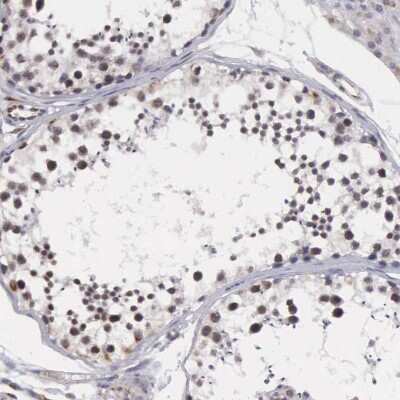 Immunohistochemistry-Paraffin: MORC2 Antibody [NBP1-89295]