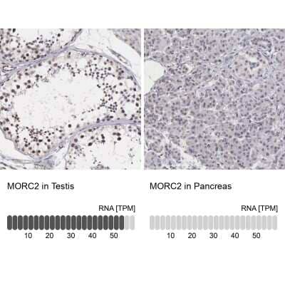 Immunohistochemistry-Paraffin: MORC2 Antibody [NBP1-89295]