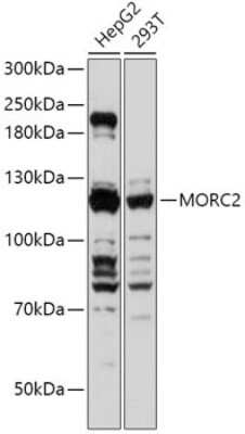 Western Blot: MORC2 AntibodyAzide and BSA Free [NBP3-05127]