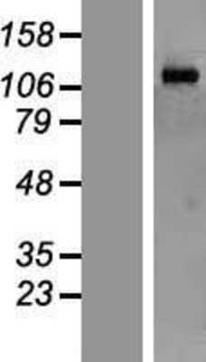 Western Blot: MORC2 Overexpression Lysate [NBL1-13181]