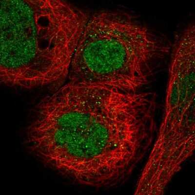 Immunocytochemistry/ Immunofluorescence: MORC3 Antibody [NBP2-56825]