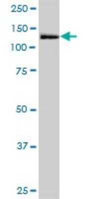 Western Blot: MORC3 Antibody [H00023515-B01P]