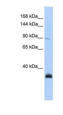 Western Blot: MORC3 Antibody [NBP1-53029]