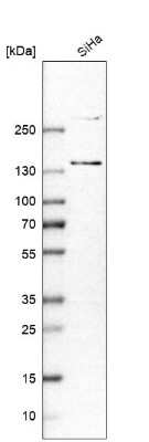 Western Blot: MORC3 Antibody [NBP1-83036]