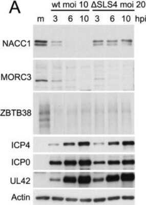 Western Blot: MORC3 Antibody [NBP1-83036]