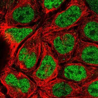 Immunocytochemistry/ Immunofluorescence: MORC4 Antibody [NBP1-82318]