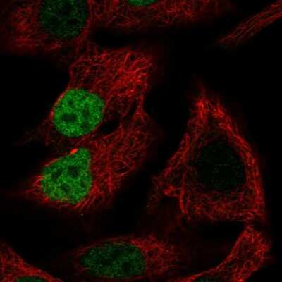 Immunocytochemistry/ Immunofluorescence: MORC4 Antibody [NBP2-55633]