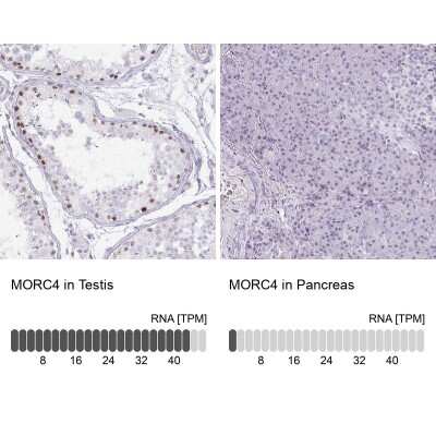 Immunohistochemistry-Paraffin: MORC4 Antibody [NBP2-33874]