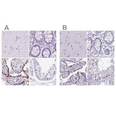 Immunohistochemistry-Paraffin: MORC4 Antibody [NBP2-33874]