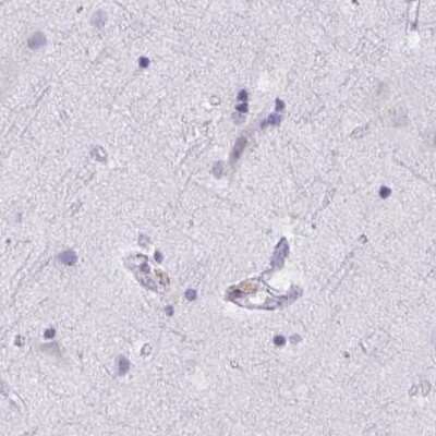 Immunohistochemistry-Paraffin: MORC4 Antibody [NBP2-33874]