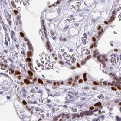 Immunohistochemistry-Paraffin: MORC4 Antibody [NBP2-33874]