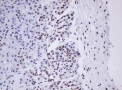 Immunohistochemistry: MORF4 Antibody (OTI5F2) [NBP2-45818]