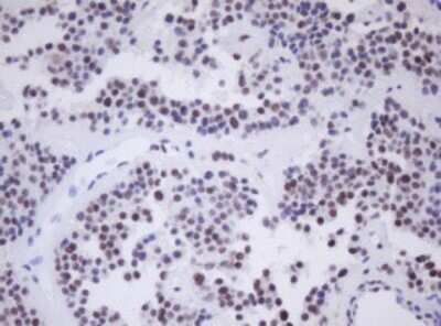 Immunohistochemistry: MORF4 Antibody (OTI5F2) [NBP2-45818]