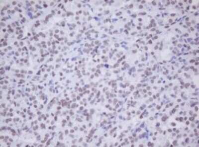 Immunohistochemistry: MORF4 Antibody (OTI5F2) [NBP2-45818]