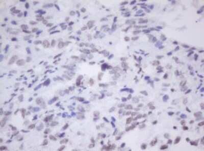 Immunohistochemistry: MORF4 Antibody (OTI5F2) [NBP2-45818]