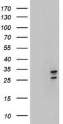 Western Blot: MORF4 Antibody (OTI5F2) [NBP2-45818]