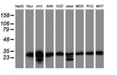Western Blot: MORF4 Antibody (OTI5F2)Azide and BSA Free [NBP2-72769]