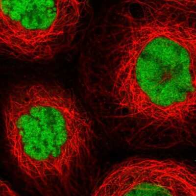 Immunocytochemistry/ Immunofluorescence: MORF4L2 Antibody [NBP2-47370]