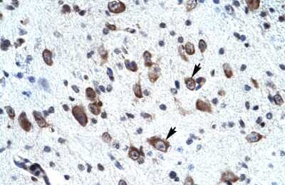 Immunohistochemistry-Paraffin: MORF4L2 Antibody [NBP2-87816]