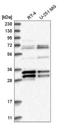 Western Blot: MORF4L2 Antibody [NBP2-58131]