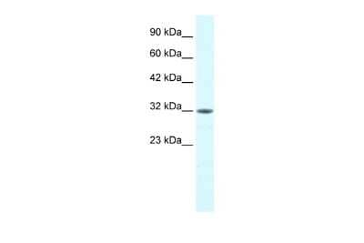 Western Blot: MORF4L2 Antibody [NBP2-87816]