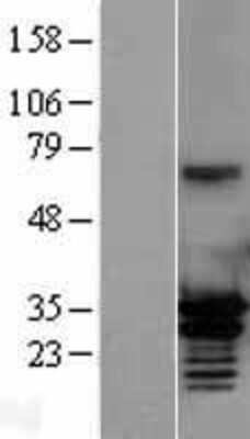 Western Blot: MORF4L2 Overexpression Lysate [NBL1-13184]