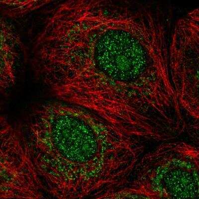 Immunocytochemistry/ Immunofluorescence: MORN1 Antibody [NBP1-94013]