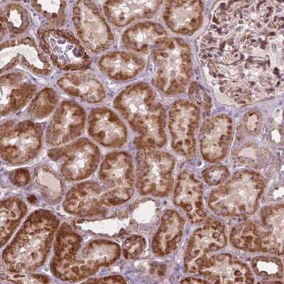 Immunohistochemistry: MORN1 Antibody [NBP2-49643]