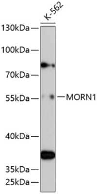 Western Blot: MORN1 AntibodyAzide and BSA Free [NBP2-93660]