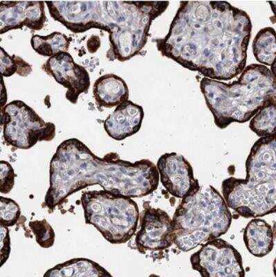Immunohistochemistry: MORN3 Antibody [NBP2-30560]