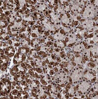 Immunohistochemistry: MORN3 Antibody [NBP2-31007]