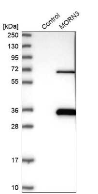 Western Blot: MORN3 Antibody [NBP2-30560]