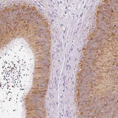 Immunohistochemistry-Paraffin: MORN4 Antibody [NBP2-30713]