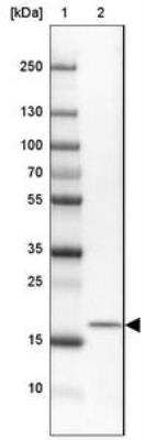 Western Blot: MORN4 Antibody [NBP2-30713]