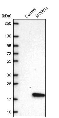 Western Blot: MORN4 Antibody [NBP2-30713]